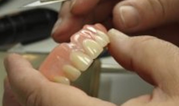 Dentures repairs and relines in calgary