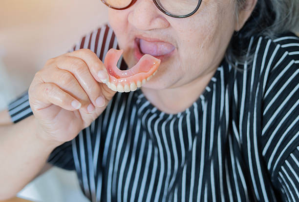 how to eat with a complete new denture