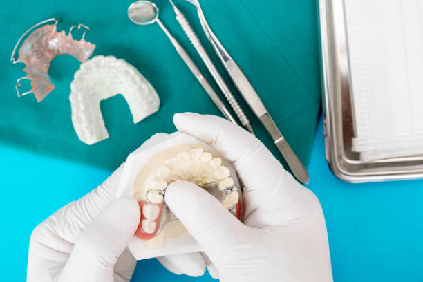 restoring your smile with custom partial dentures